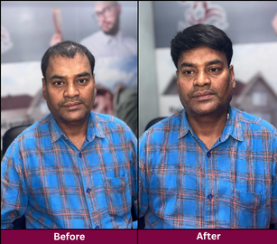 Transformation 1