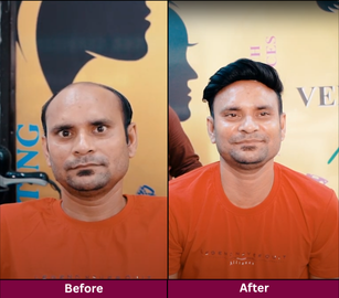 Transformation 2