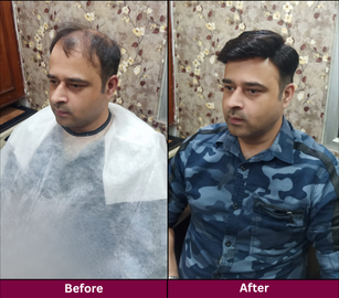Transformation 3