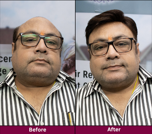 Transformation 4