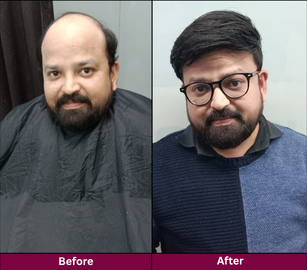 Transformation 5