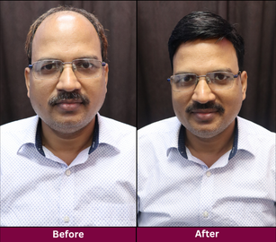 Transformation 6