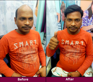 Transformation 7