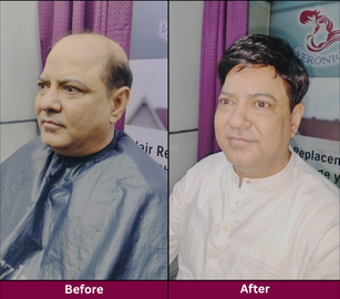Transformation 8