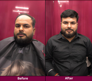 Transformation 9